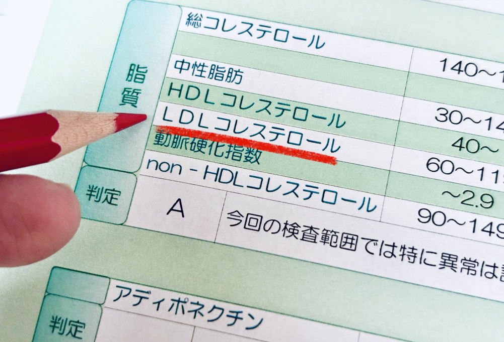 脂質異常症（高脂血症）とは