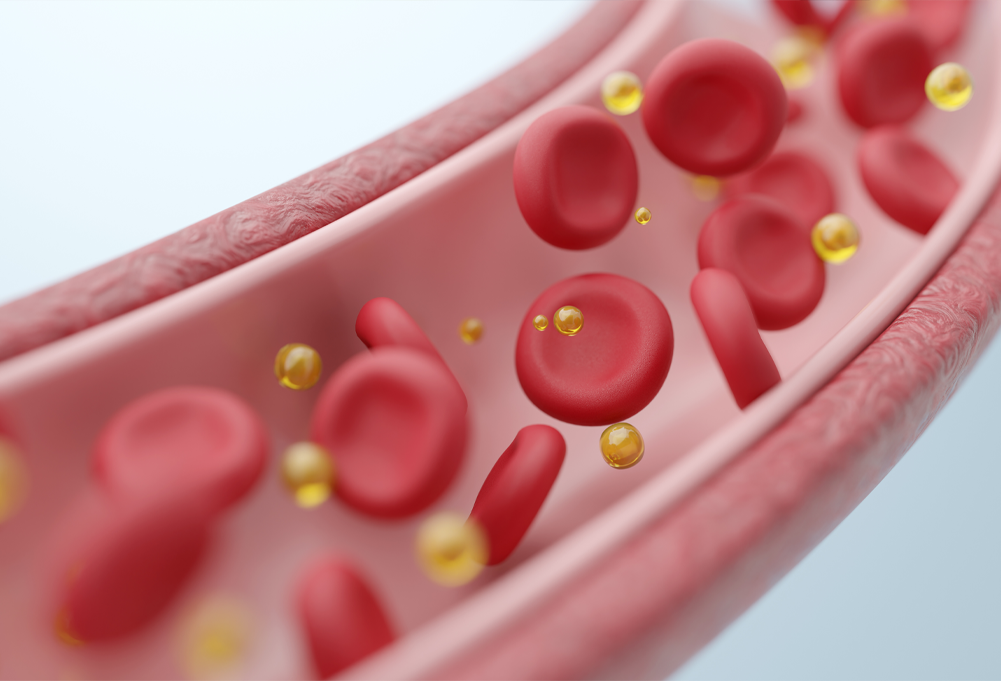 脂質異常症について