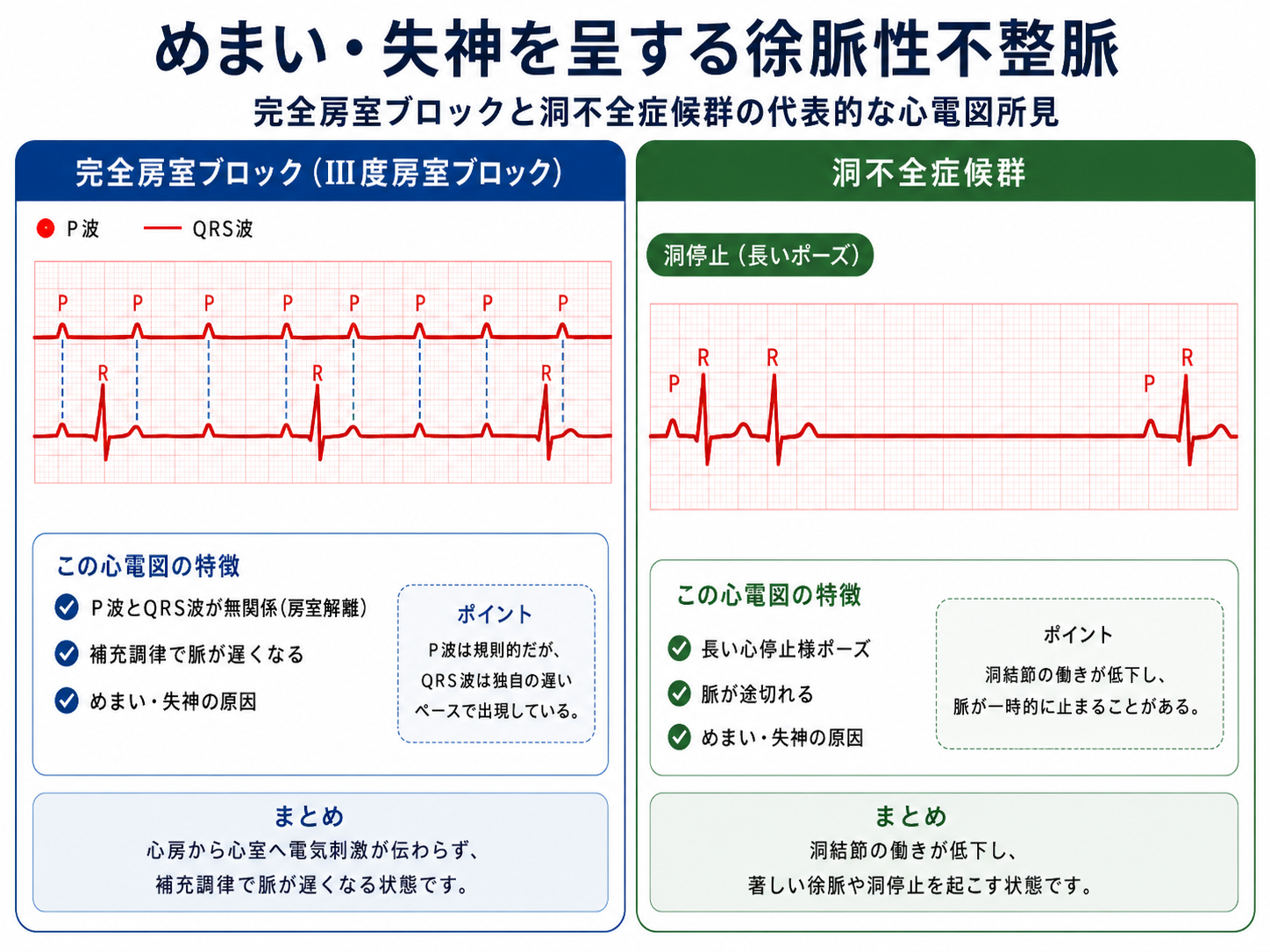 めまいを起こすような代表的な徐脈性不整脈のイラスト