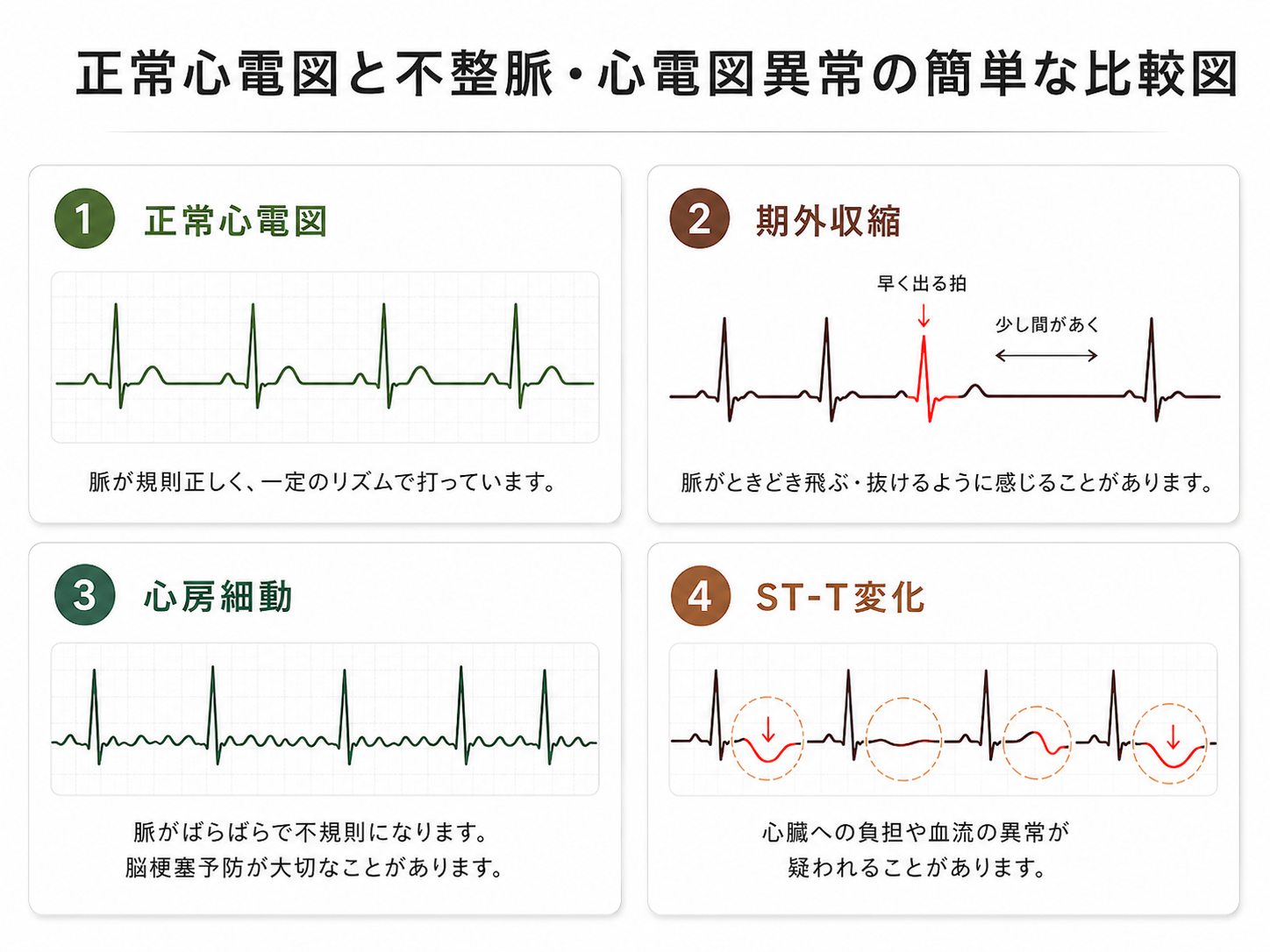 正常心電図とよくある健診での心電図異常の比較
