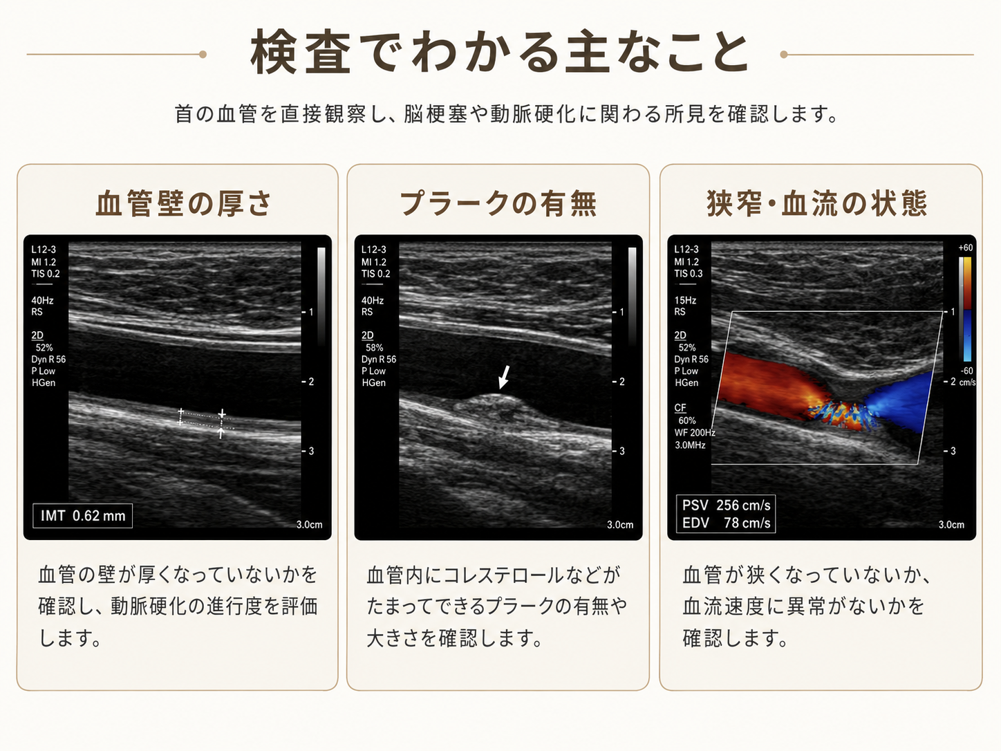頸動脈超音波検査｜動脈硬化の検査｜本多内科医院｜横浜市神奈川区反町